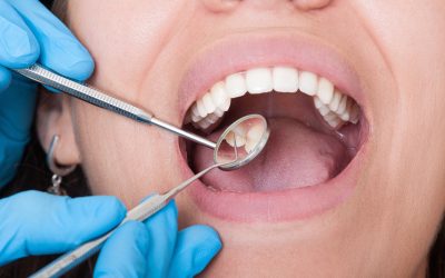 What is the D0140 Dental Code: A Thorough Description